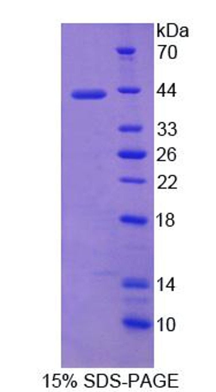 Human Recombinant Neuronal Cell Adhesion Molecule (NRCAM)