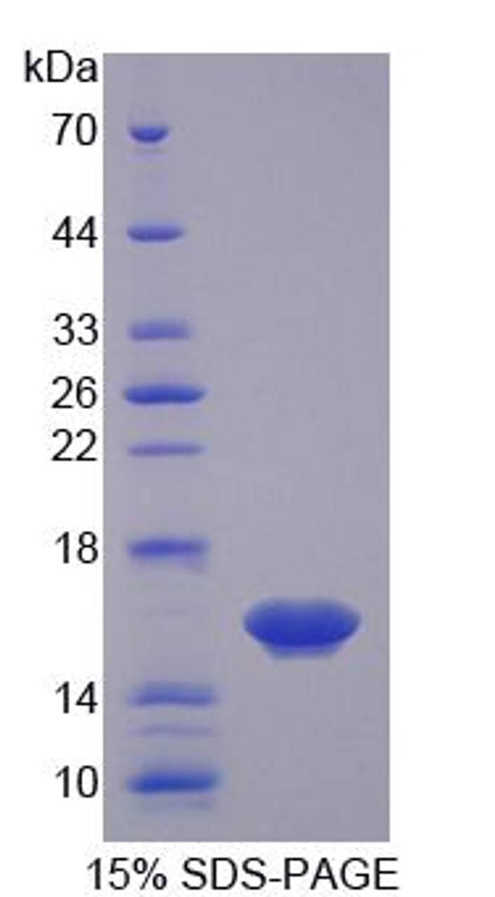 Mouse Recombinant Osteoglycin (OGN)