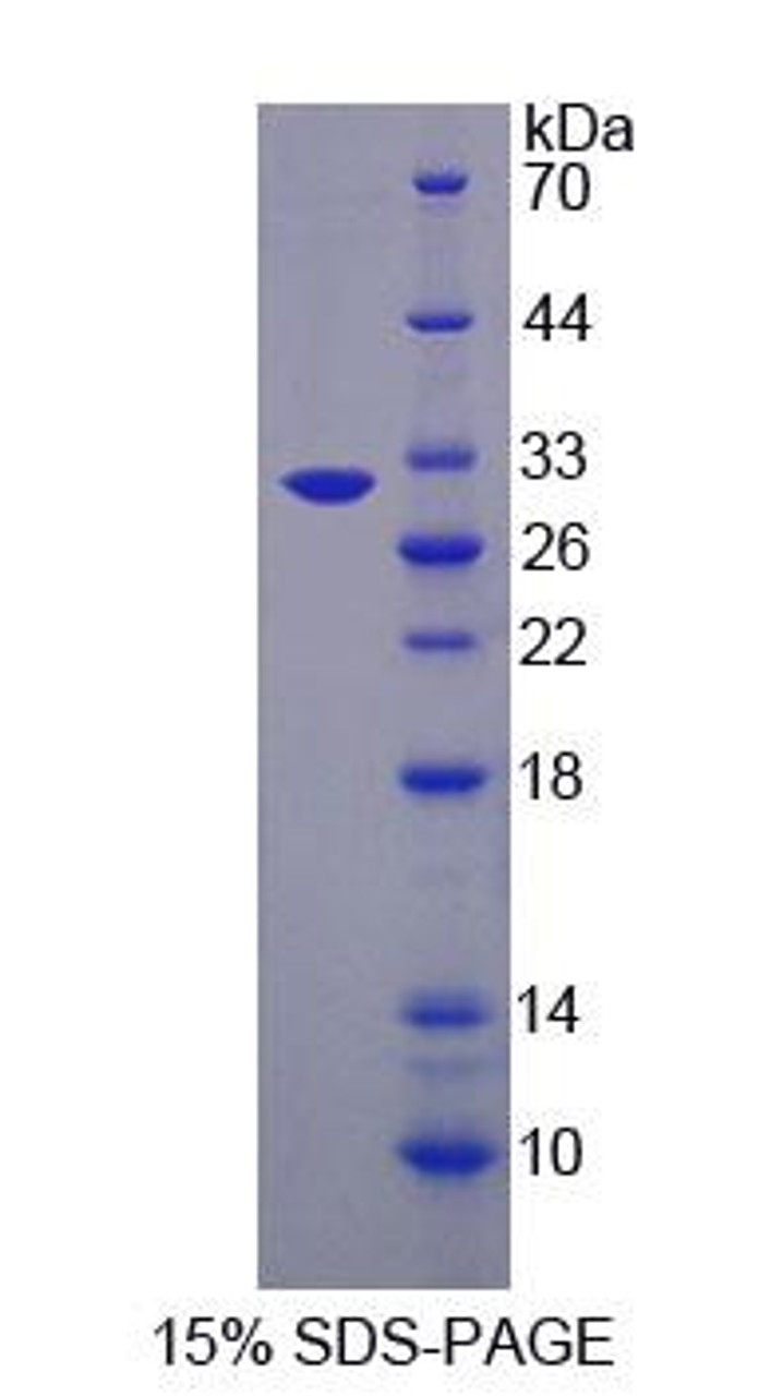 Mouse Recombinant Osteosarcoma Amplified 9 (OS9)