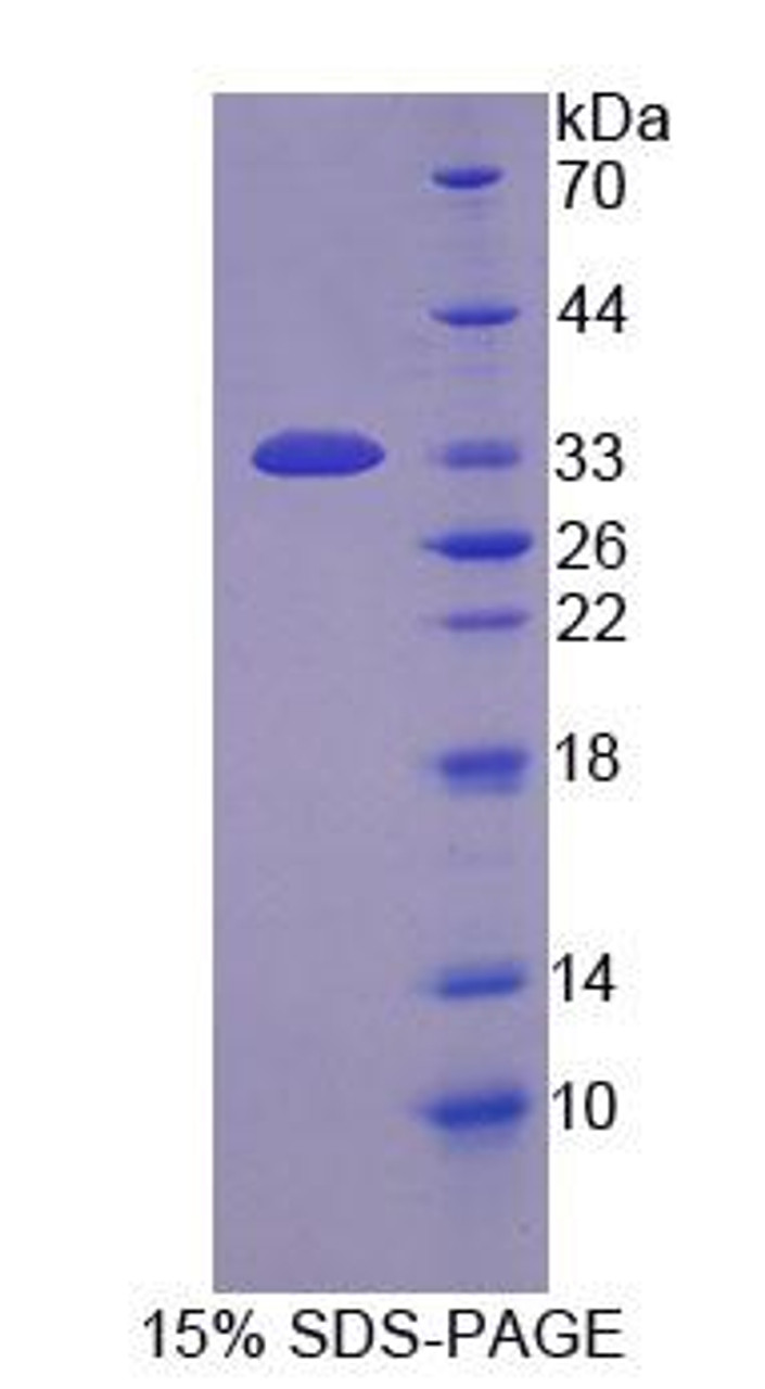 Human Recombinant Peptidyl Arginine Deiminase Type I (PADI1)