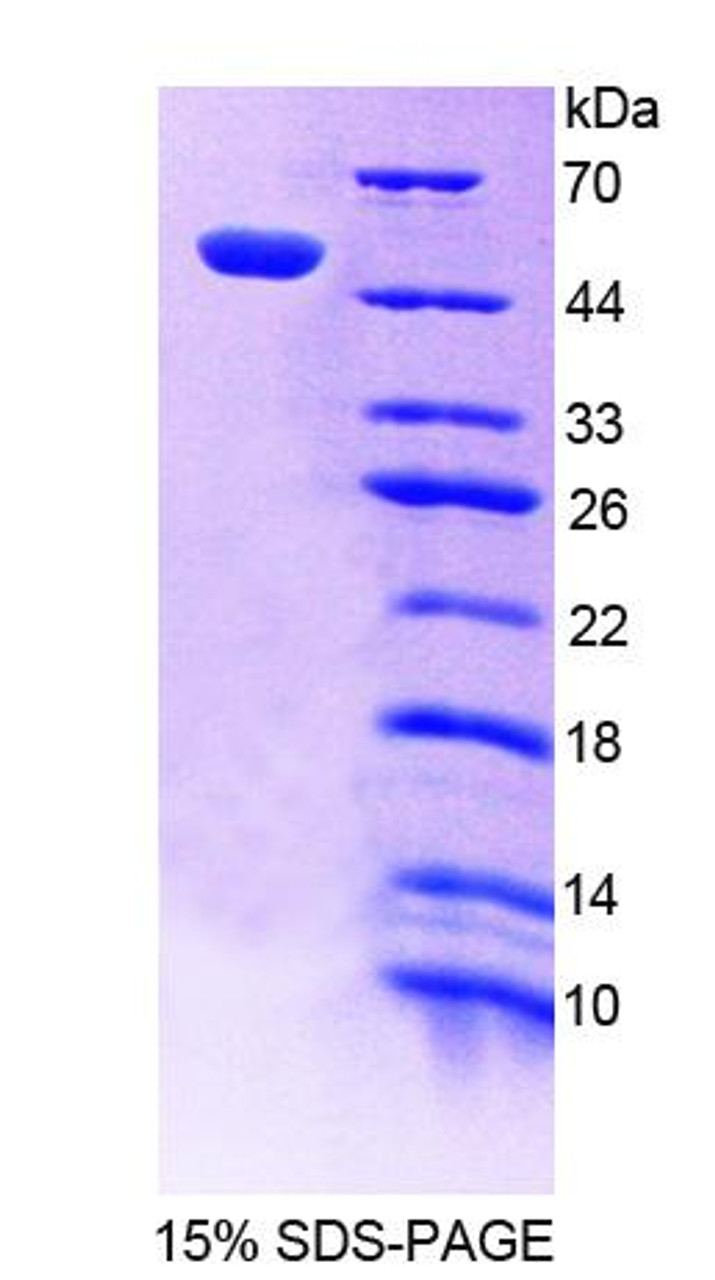 Human Recombinant Polymerase DNA Directed Delta 1 (POLd)