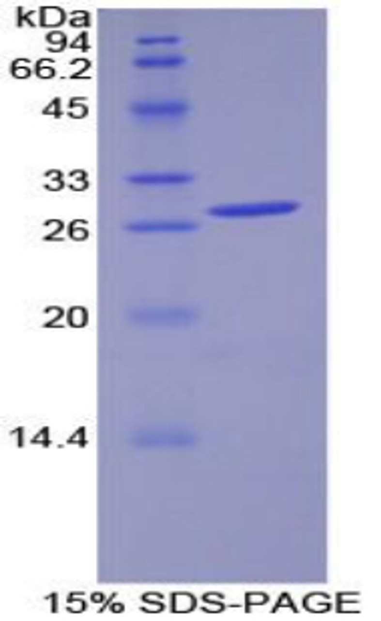 Human Recombinant Pyruvate Dehydrogenase Kinase Isozyme 1 (PDK1)