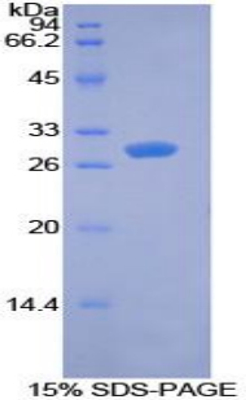 Mouse Recombinant Pyruvate Dehydrogenase Kinase Isozyme 1 (PDK1)