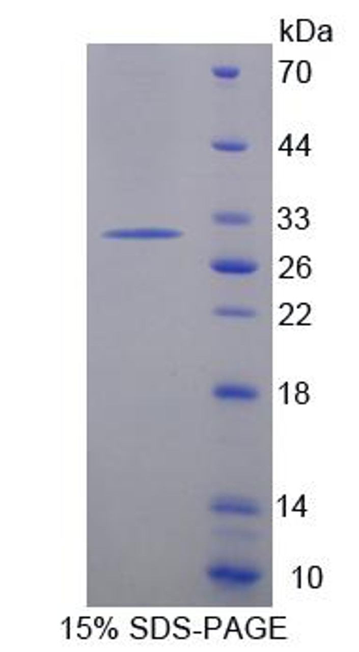 Mouse Recombinant Pituitary Tumor Transforming 1 (PTTG1)