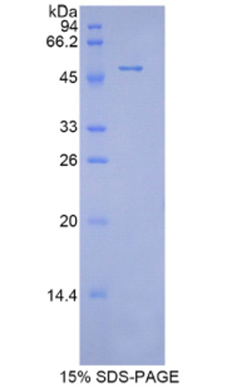 Mouse Recombinant Peroxiredoxin 1 (PRDX1)