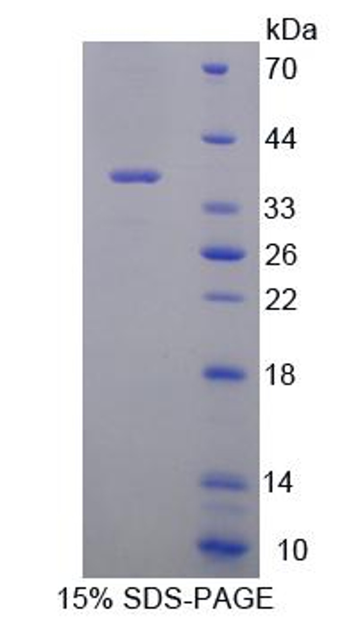 Mouse Recombinant Regucalcin (RGN)