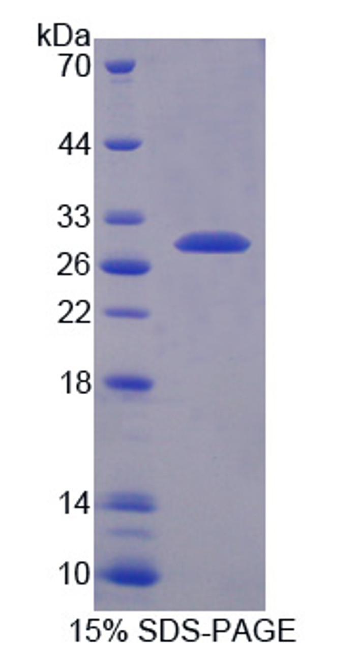 Mouse Recombinant Transmembrane Protease, Serine 2 (TMPRSS2)