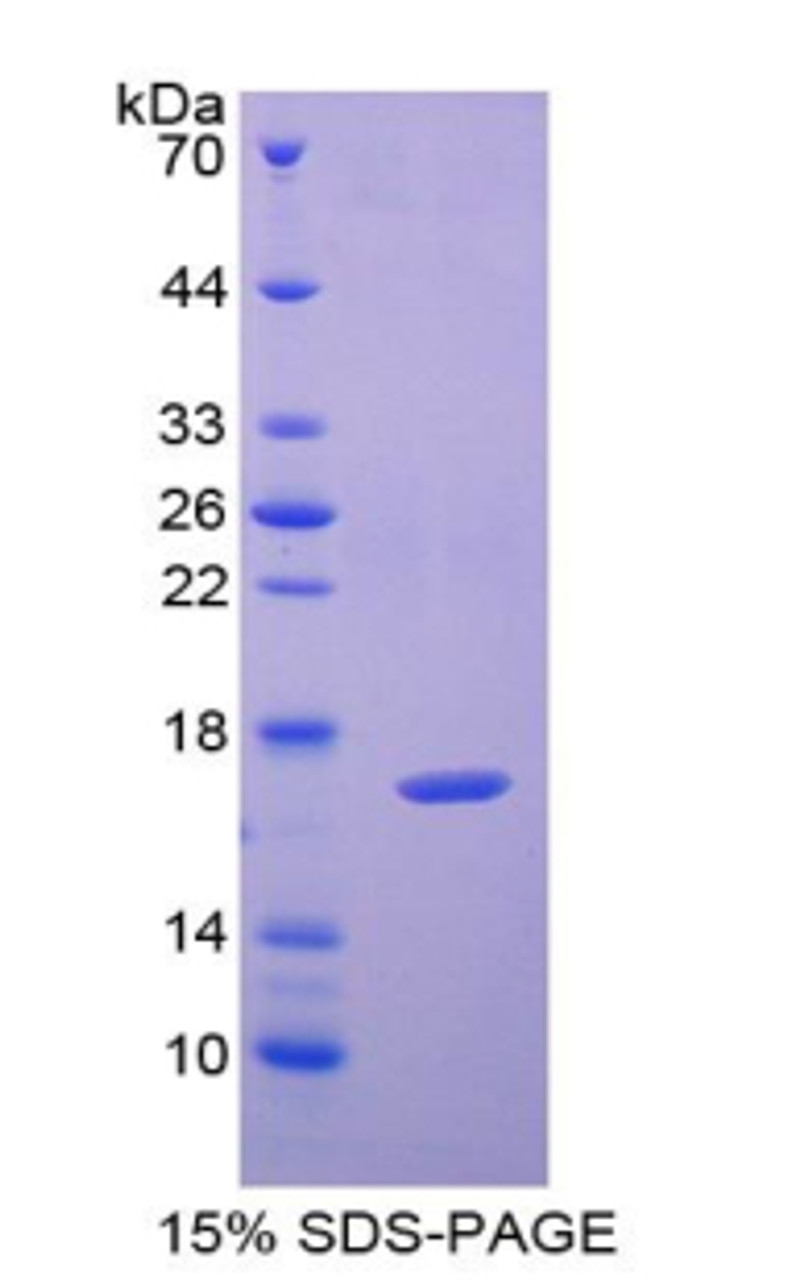 Human Recombinant Adenylyl Cyclase Associated Protein 2 (CAP2)