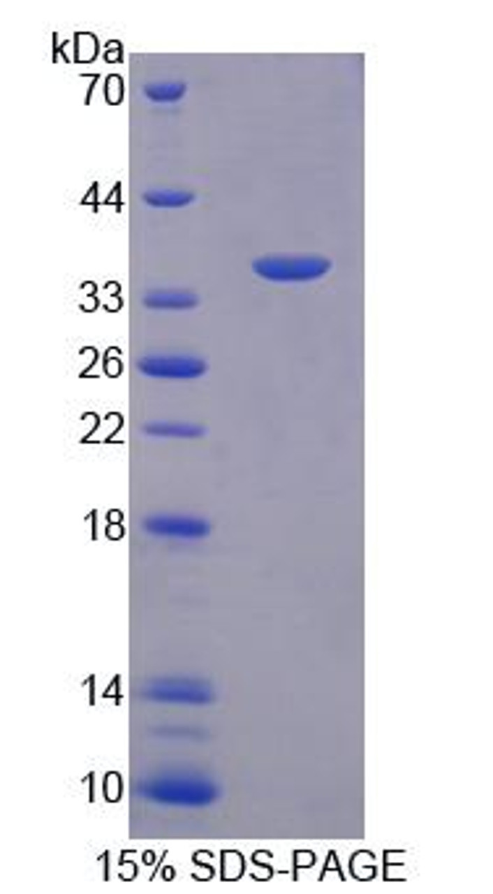 Human Recombinant Syntenin 1 (ST1)