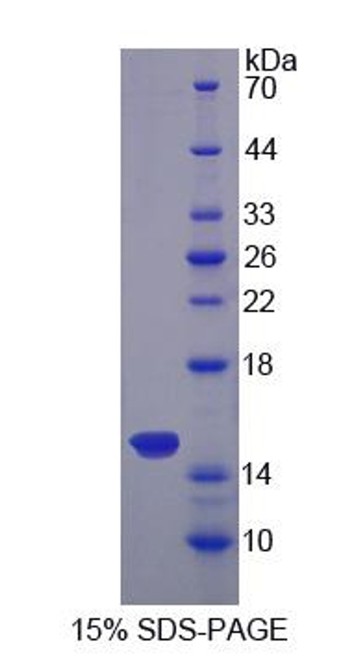 Mouse Recombinant Sideroflexin 1 (SFXN1)