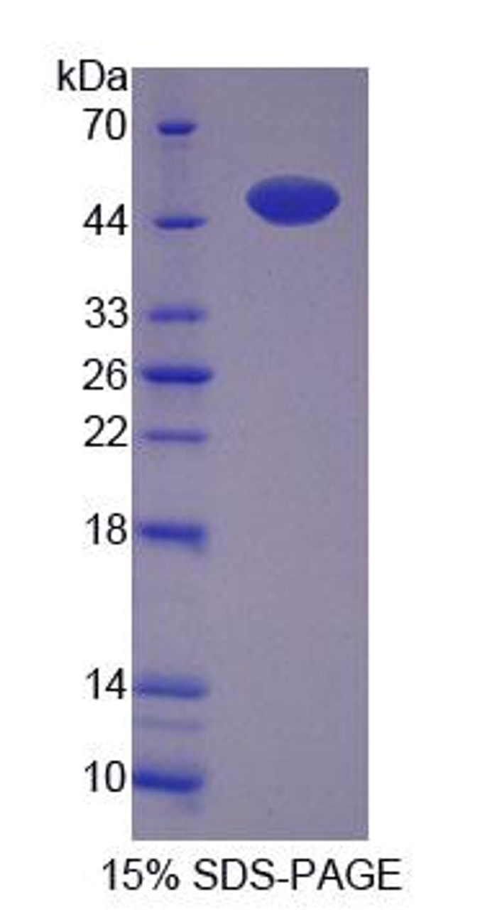 Human Recombinant Renalase (RNLS)