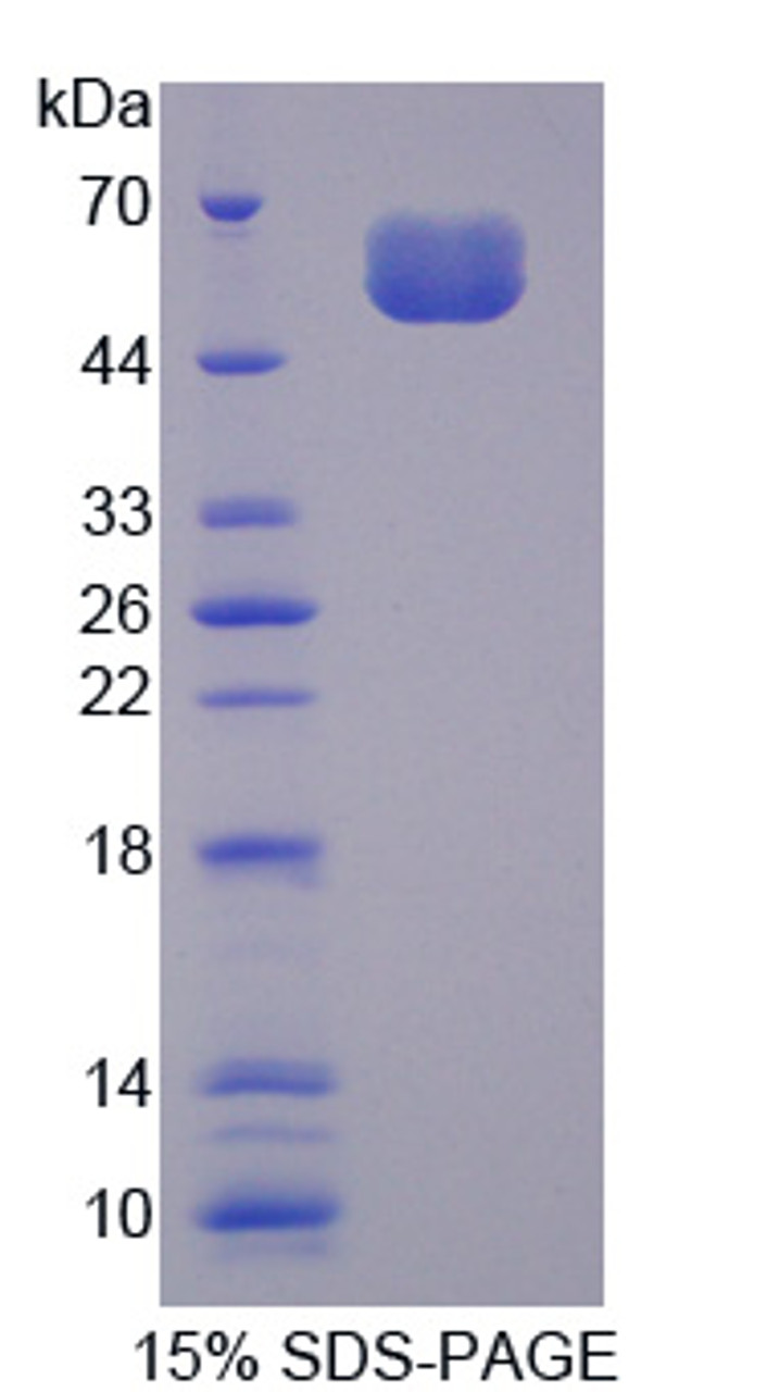 Mouse Recombinant Sclerostin (SOST)