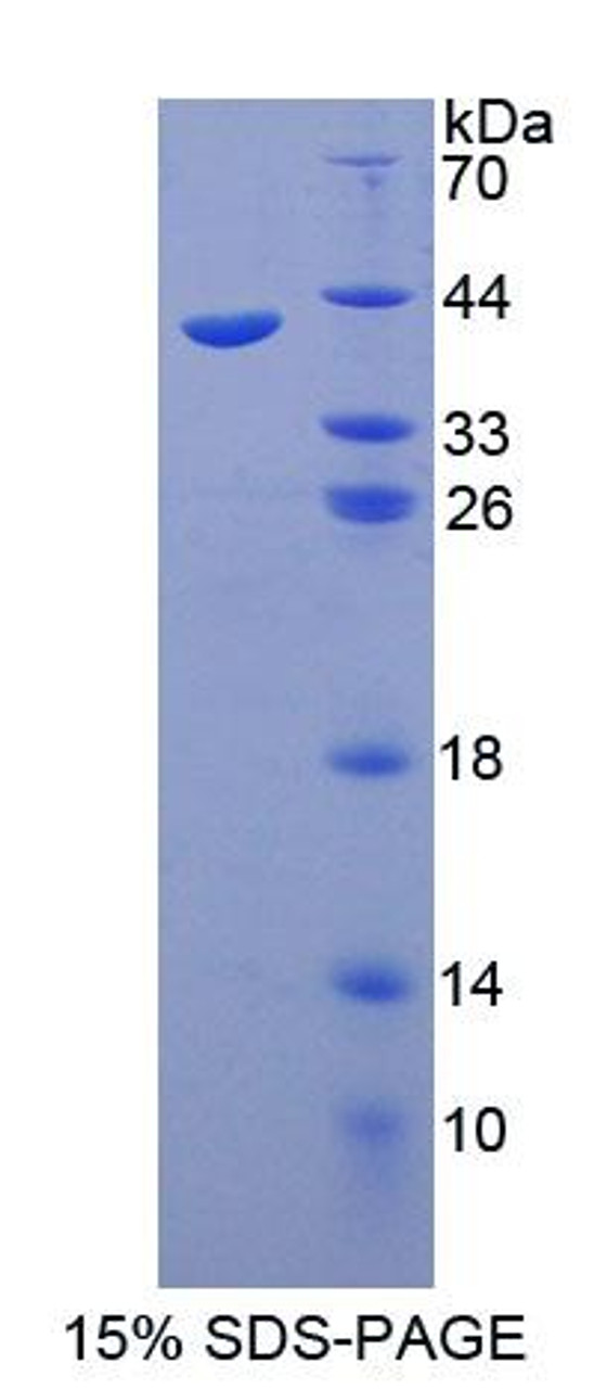 Human Recombinant Synaptotagmin I (SYT1)