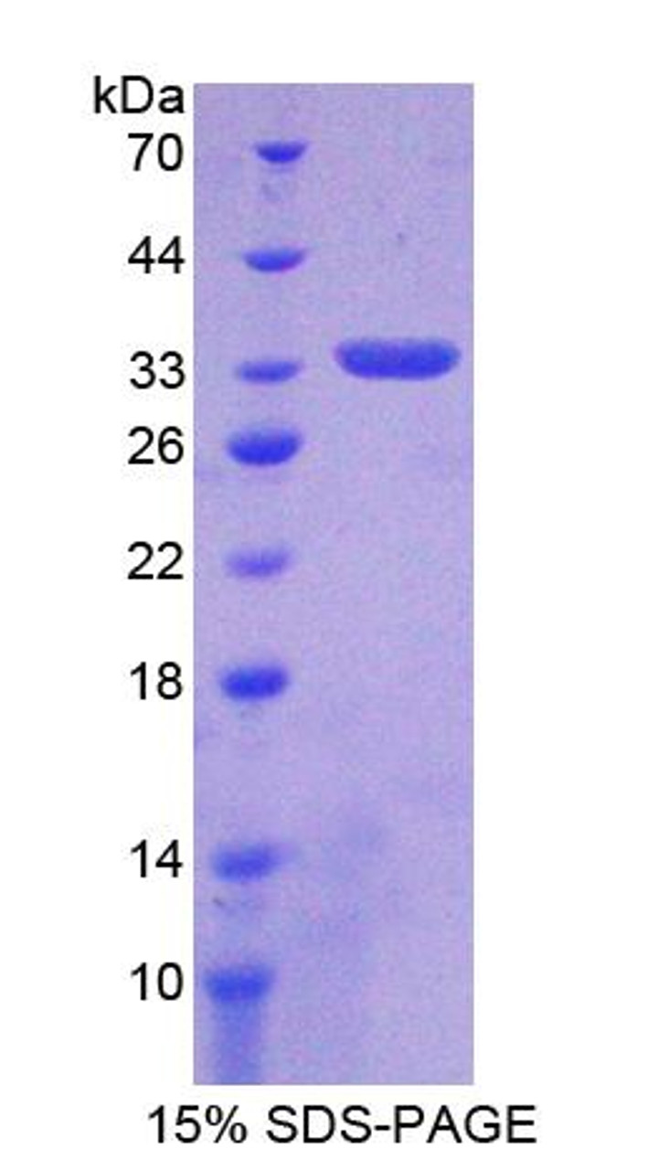 Rat Recombinant Platelet Derived Growth Factor D (PDGFD)