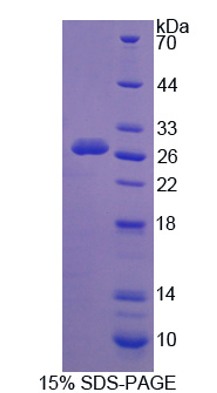 Human Recombinant Calpain 3 (CAPN3)