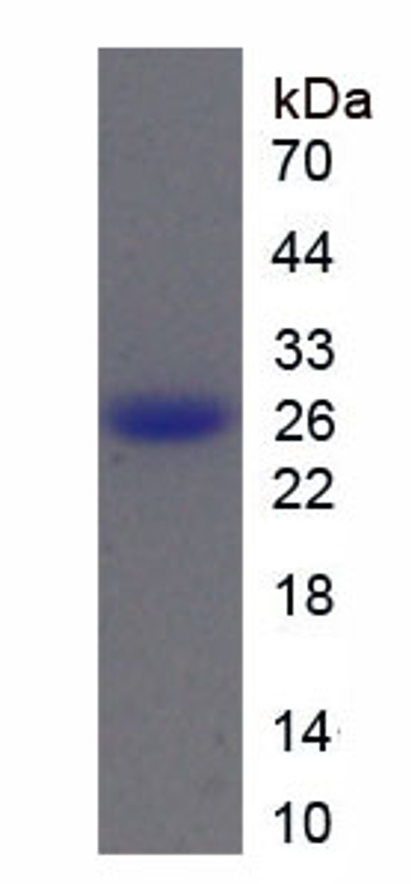 Mouse Recombinant Cathepsin B (CTSB)