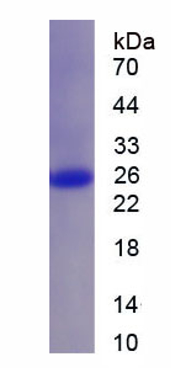 Mouse Recombinant Cathepsin C (CTSC)