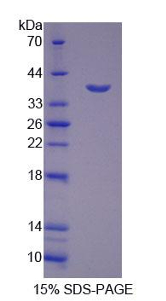 Mouse Recombinant Cathepsin H (CTSH)