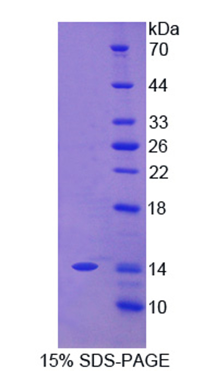 Human Recombinant Carcinoembryonic Antigen Related Cell Adhesion Molecule 7 (CEACAM7)