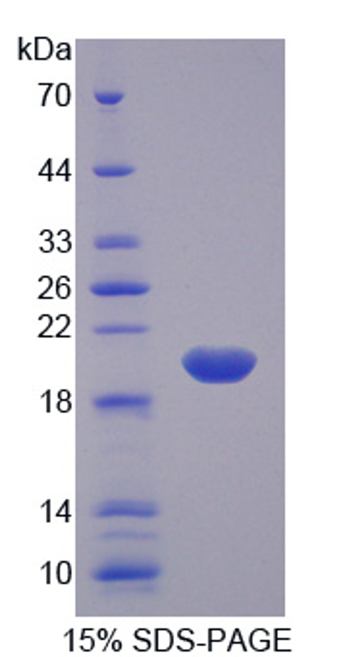 Human Recombinant Arginyl tRNA Synthetase (RARS)