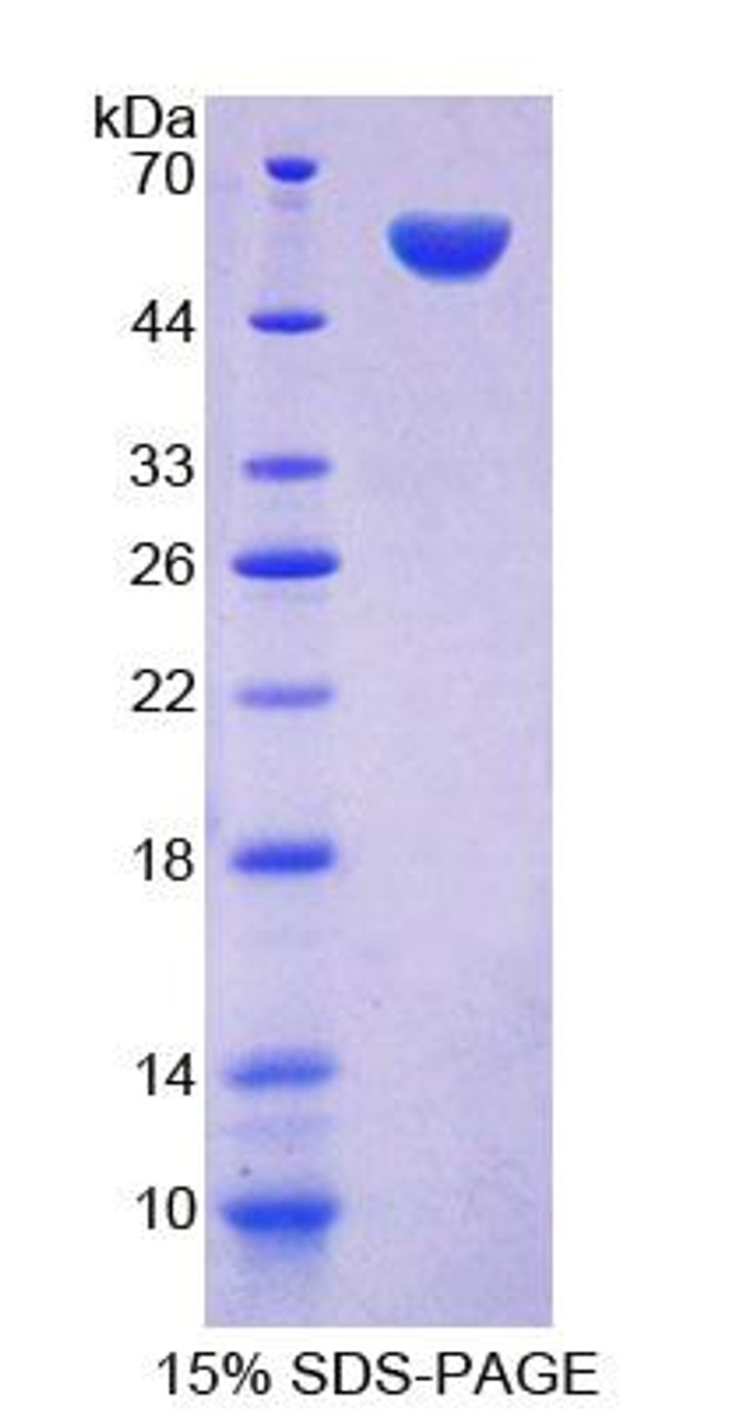 Mouse Recombinant Phenylalanyl tRNA Synthetase 2, Mitochondrial (FARS2)
