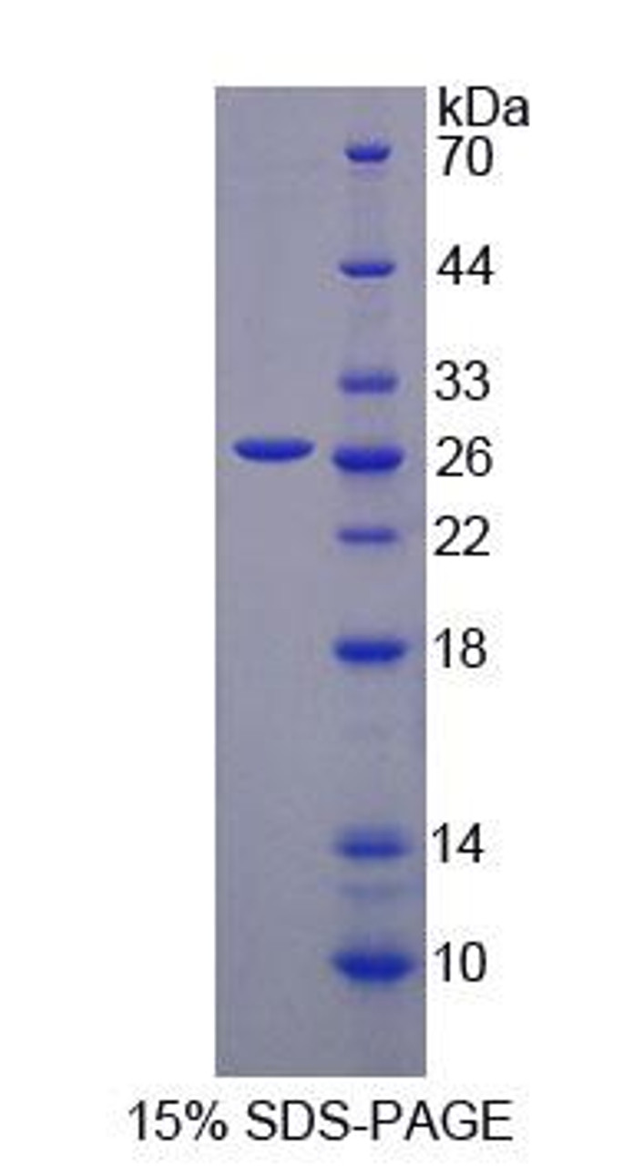 Human Recombinant Valyl tRNA Synthetase (VARS)