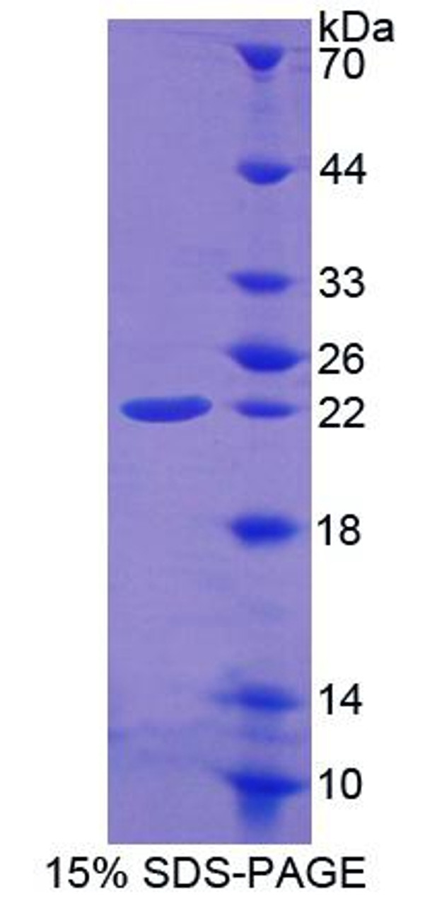 Mouse Recombinant Ferritin, Heavy Polypeptide (FTH)