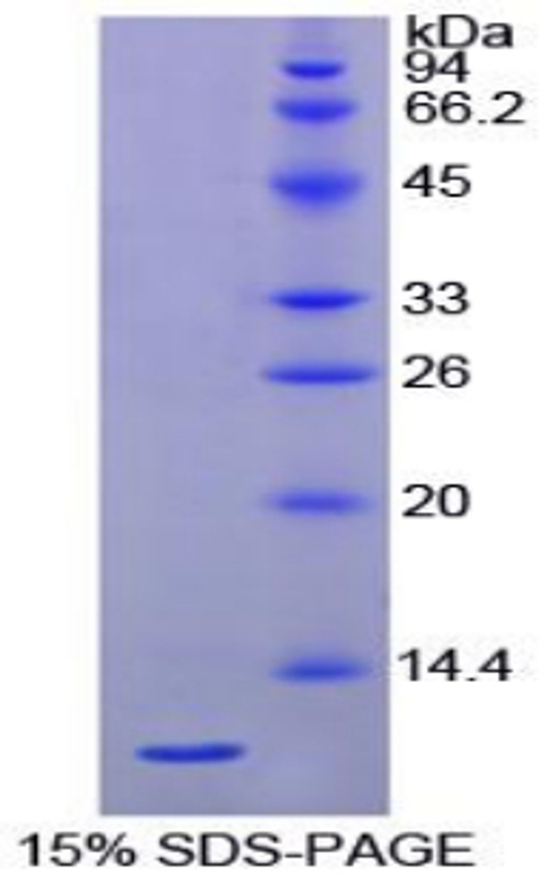 Chicken Recombinant Heat Shock 70kDa Protein 8 (HSPA8)