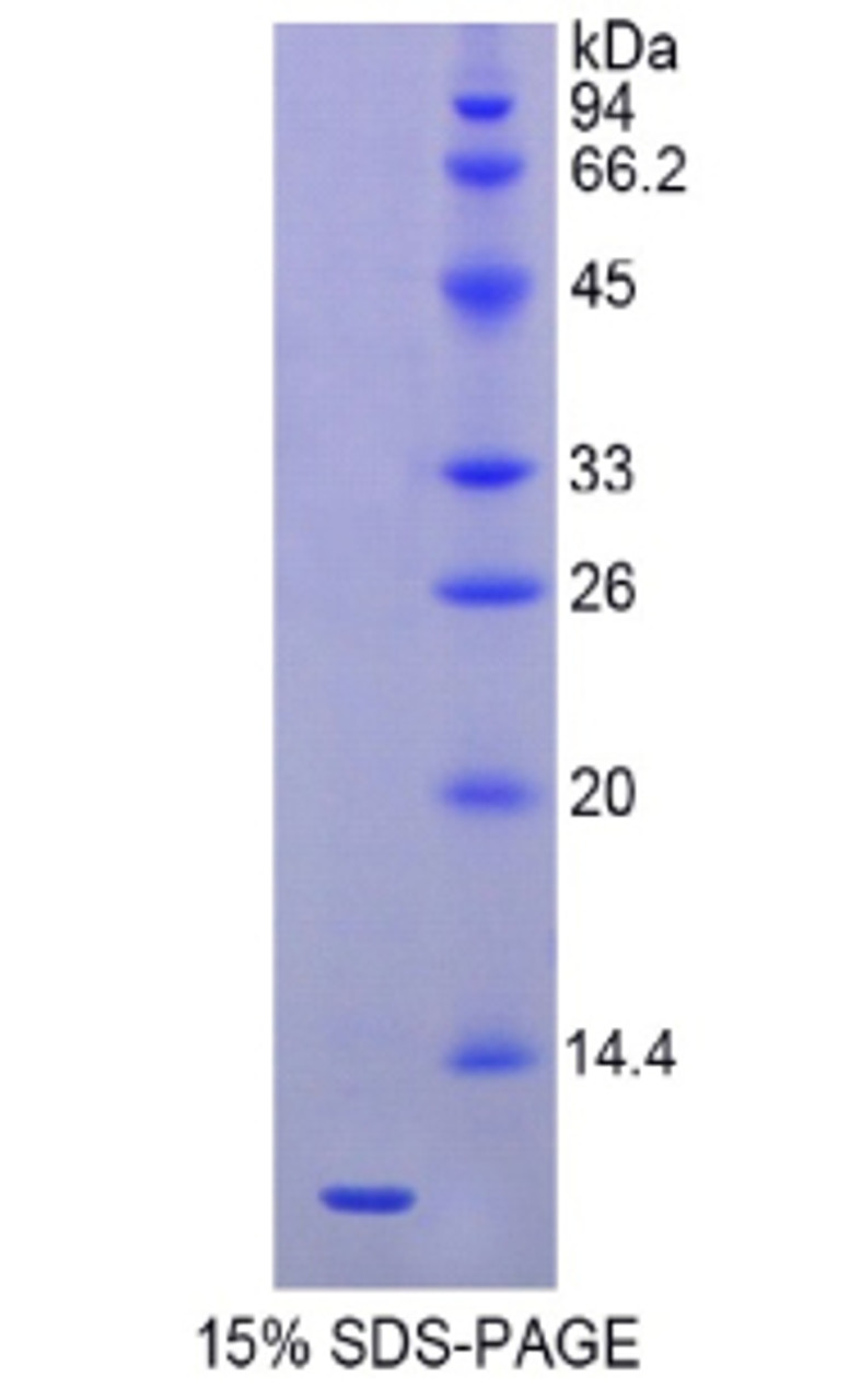 Mouse Recombinant Heat Shock 70kDa Protein 8 (HSPA8)