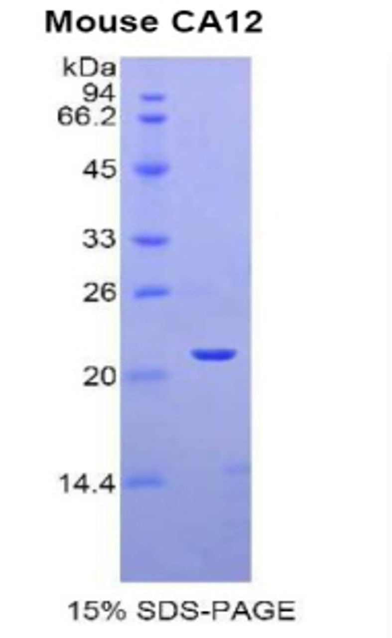 Mouse Recombinant Carbonic Anhydrase XII (CA12)