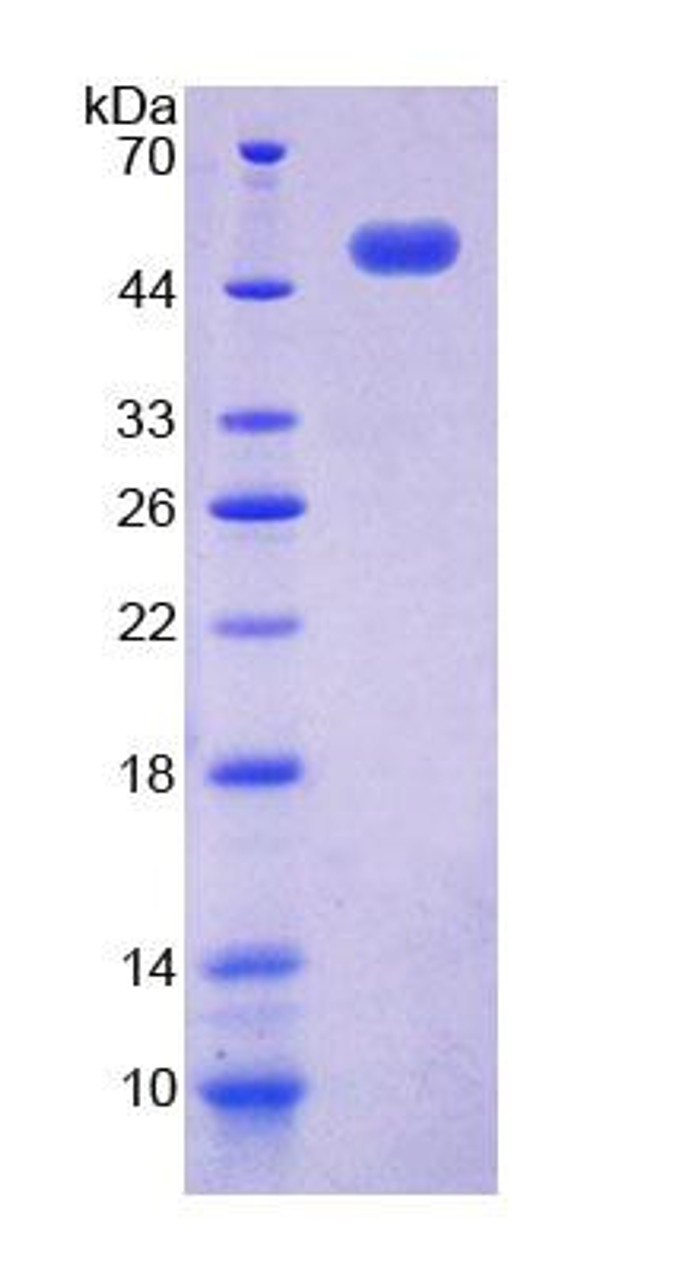 Human Recombinant Acid Phosphatase 6, Lysophosphatidic (ACP6)