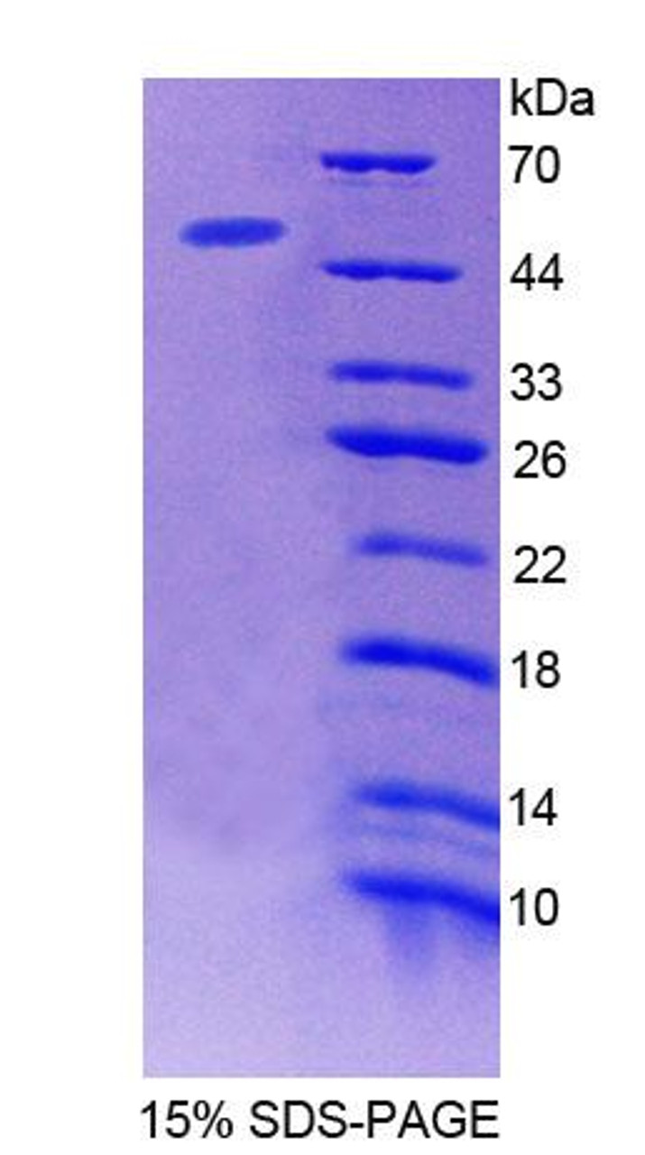 Mouse Recombinant Acid Phosphatase 6, Lysophosphatidic (ACP6)