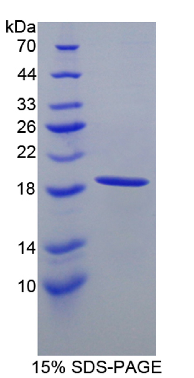 Cattle Recombinant Hemoglobin Alpha 1 (HBa1)