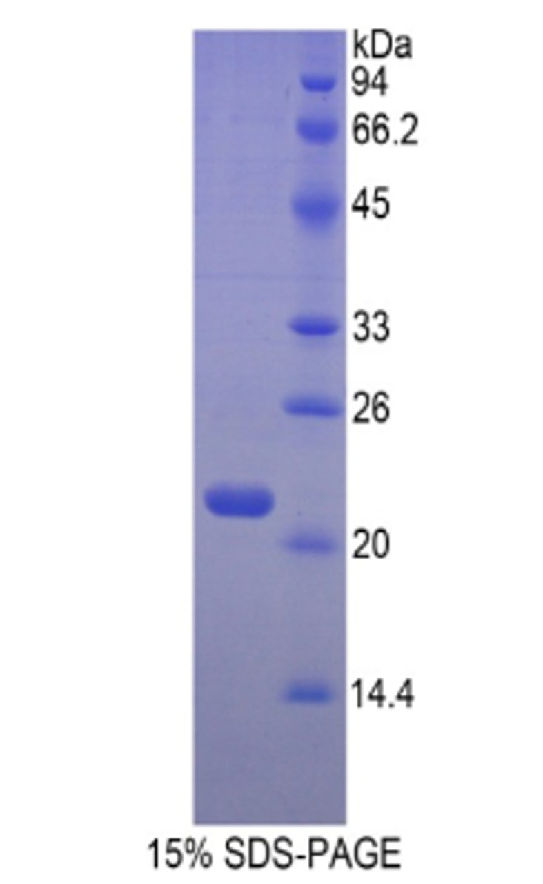 Mouse Recombinant Hemoglobin Beta (HBb)