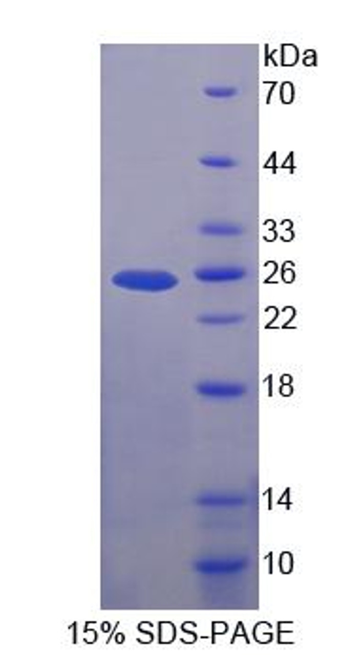 Human Recombinant Low Density Lipoprotein Receptor Related Protein 2 (LRP2)