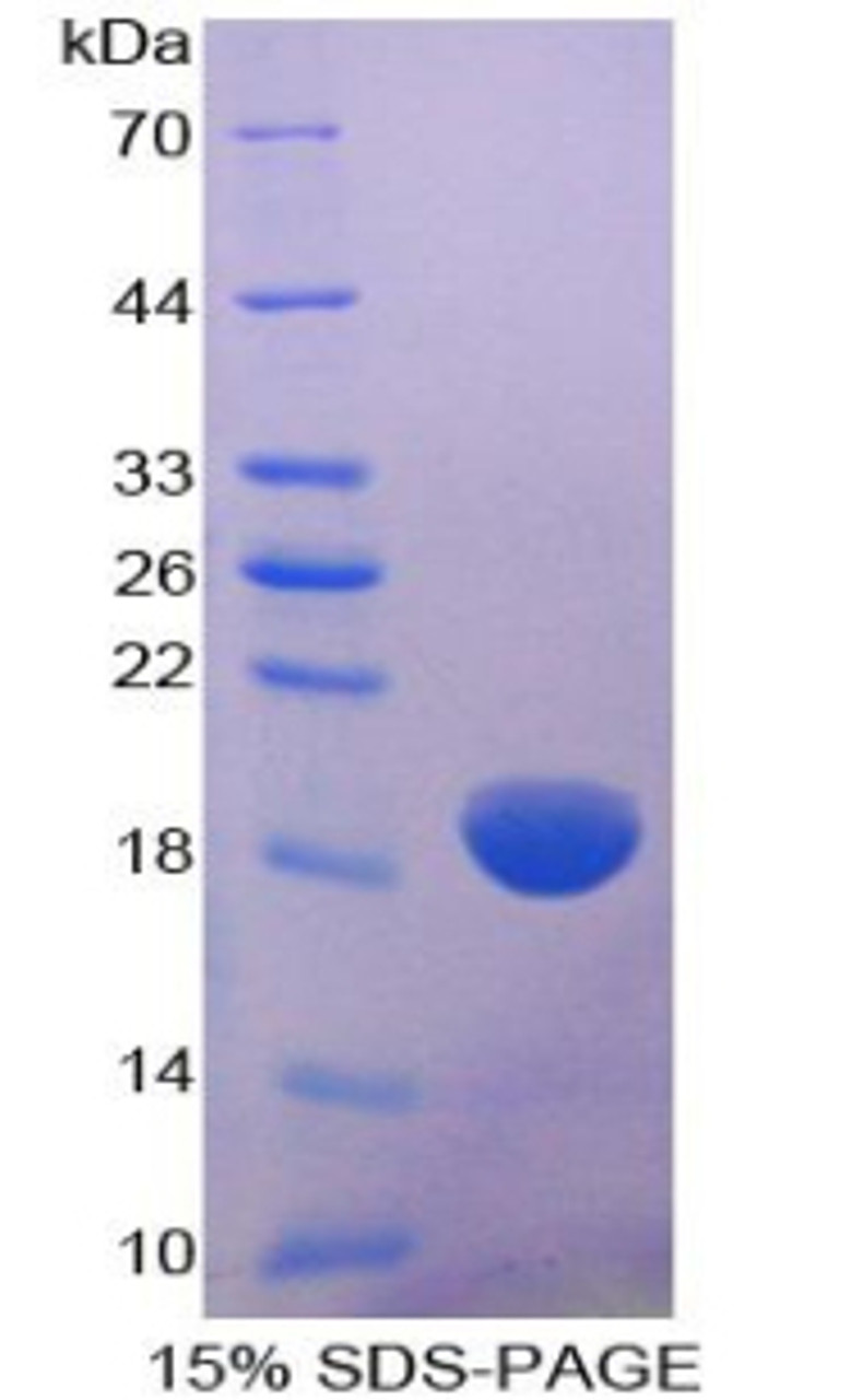 Human Recombinant Collagen Type VIII Alpha 2 (COL8a2)