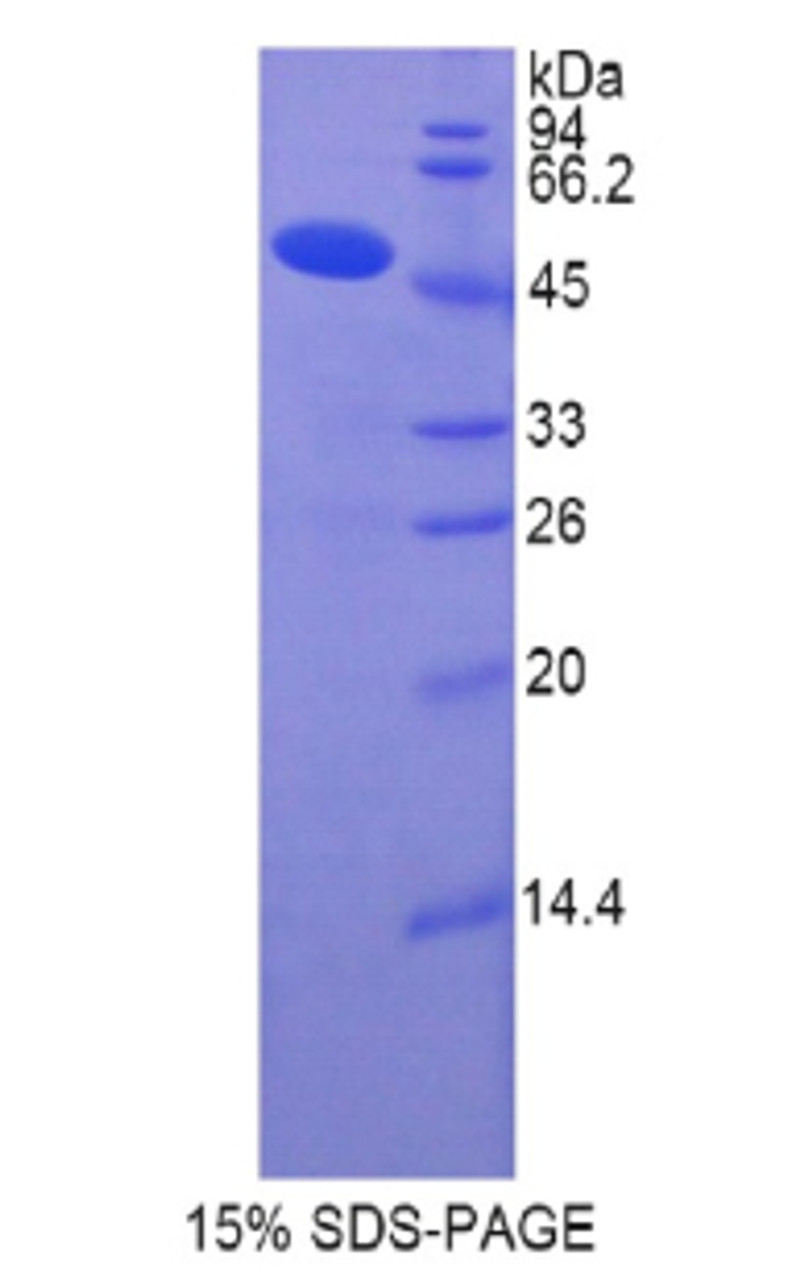 Human Recombinant Collagen Type XIV (COL14)