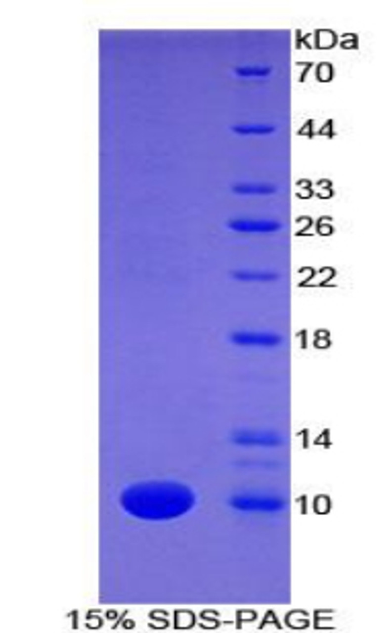 Mouse Recombinant Fibulin 5 (FBLN5)