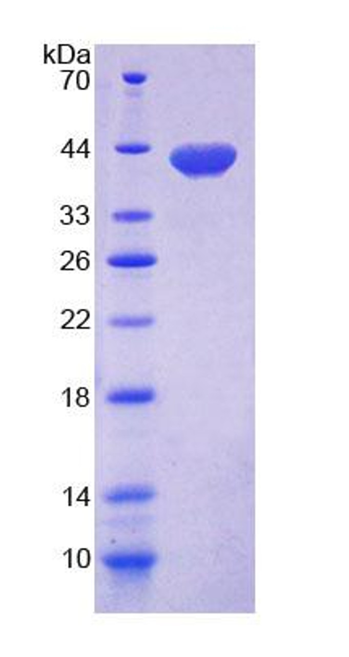 Mouse Recombinant Mannosyl Oligosaccharide Glucosidase (MOGS)