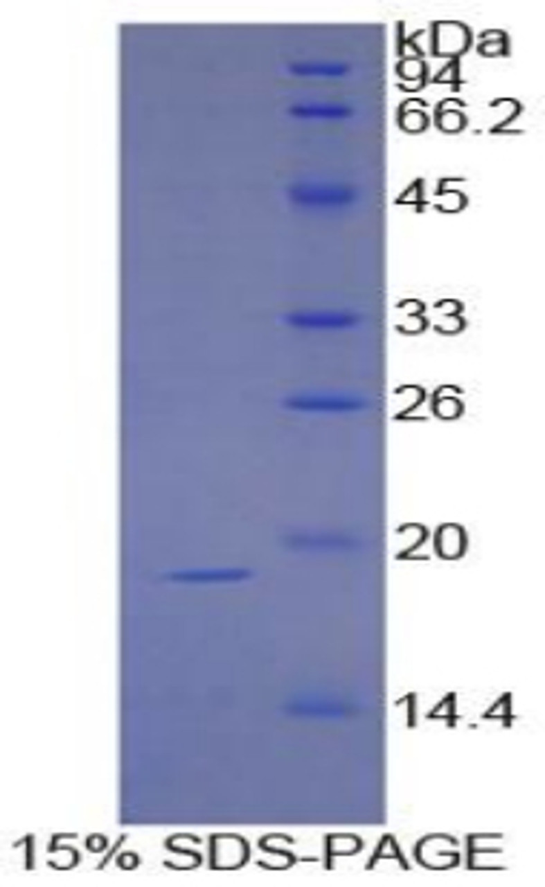 Human Recombinant Sucrase Isomaltase (SI)