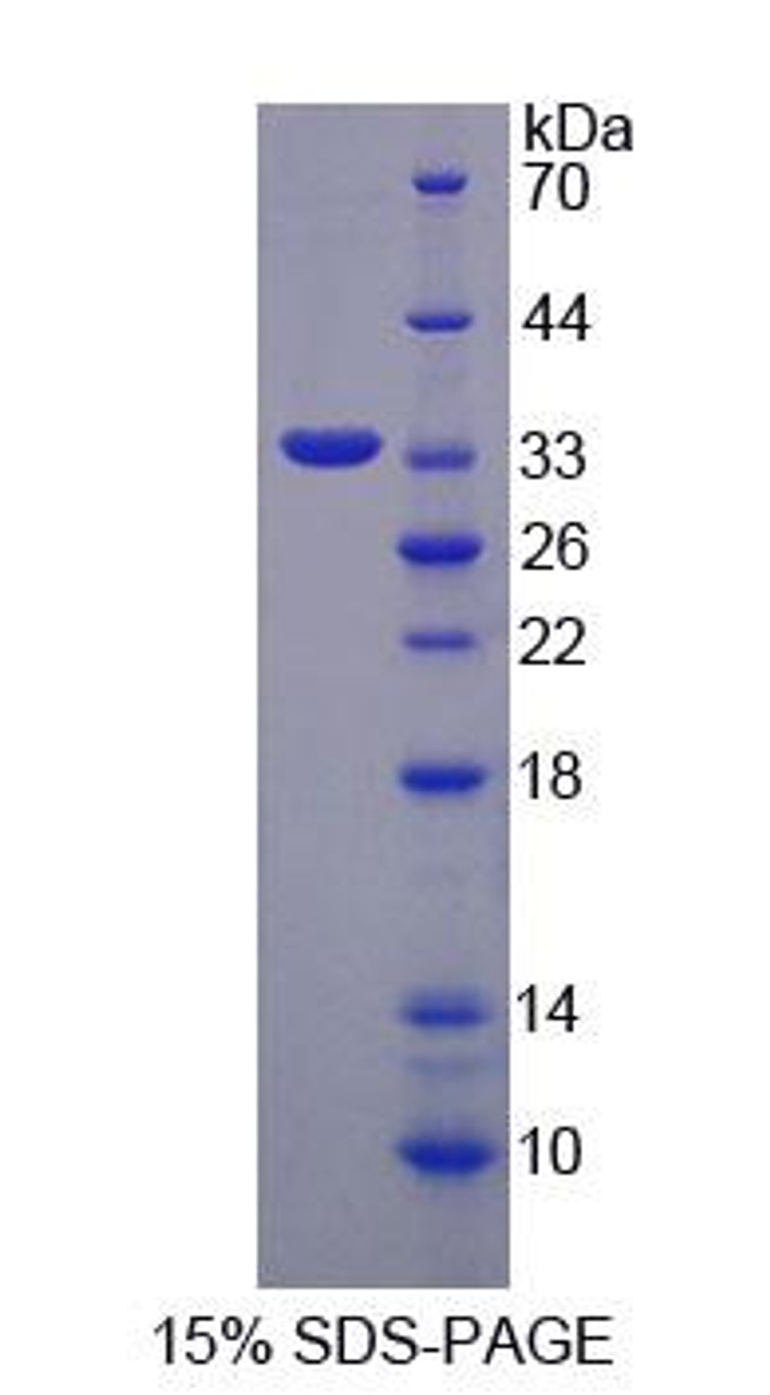 Human Recombinant Glucosidase Alpha, Neutral AB (GaNAB)