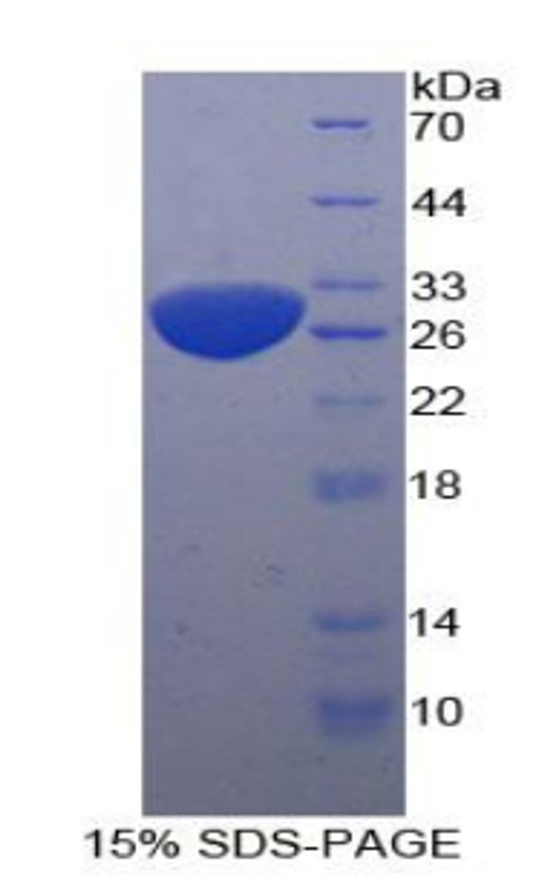 Human Recombinant Sequestosome 1 (SQSTM1)