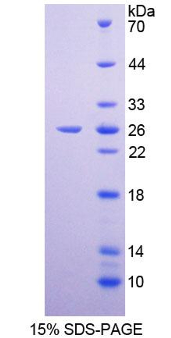 Human Recombinant Cyclin B (CCNB)