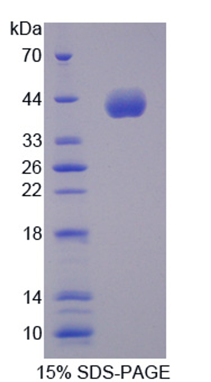 Human Recombinant Cyclin B2 (CCNB2)