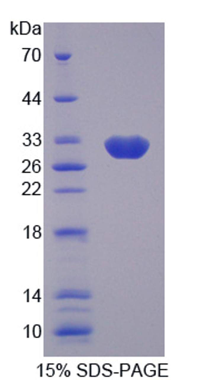 Human Recombinant Aldolase C, Fructose Bisphosphate (ALDOC)