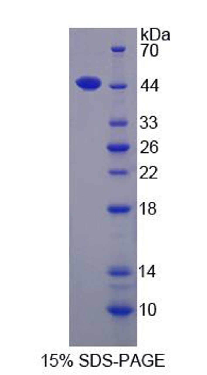 Human Recombinant Interleukin 17D (IL17D)