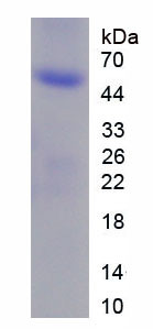 Human Recombinant Interleukin 17C (IL17C)