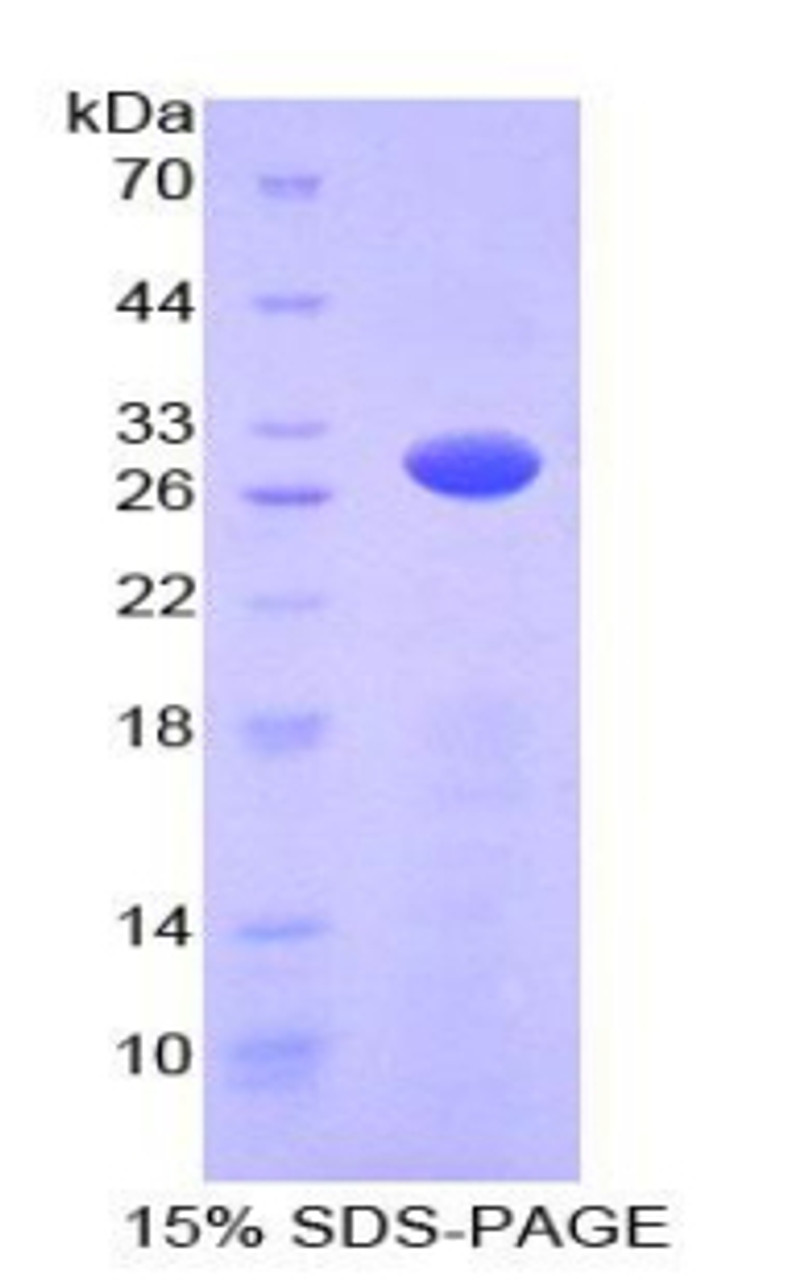 Mouse Recombinant Protein Kinase, AMP Activated Gamma 2 (PRKAg2)