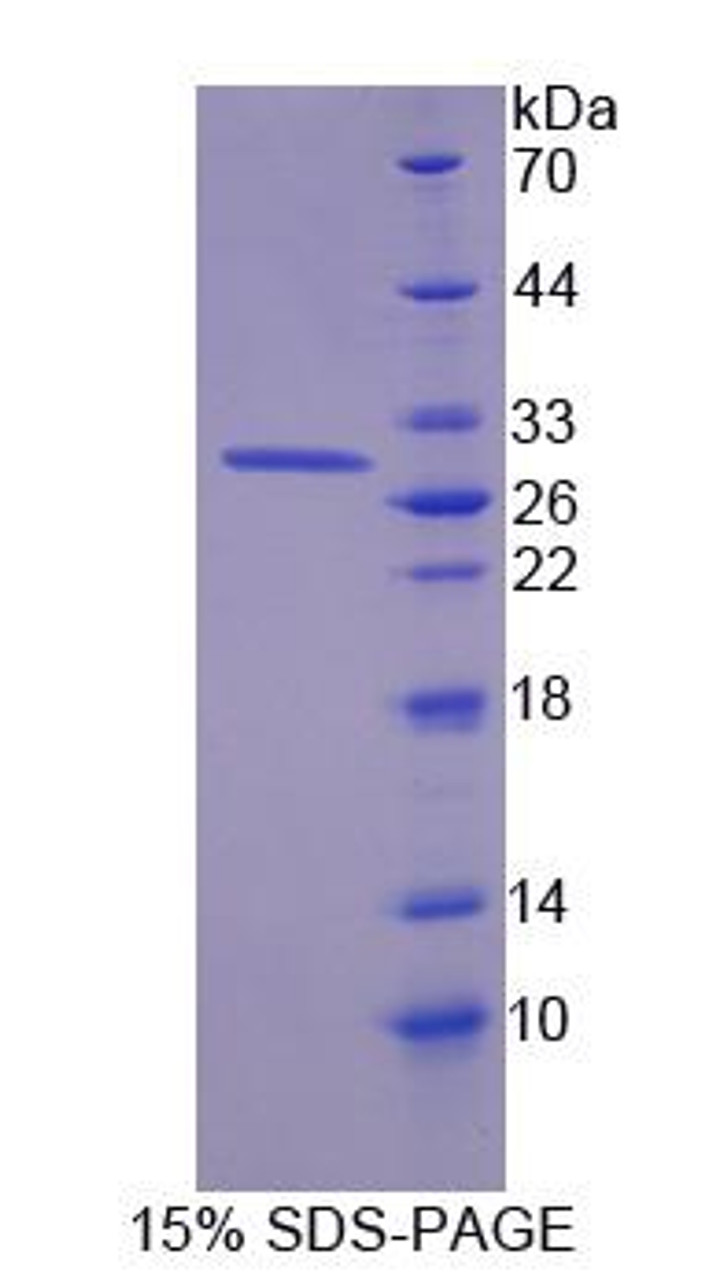 Human Recombinant Kallikrein 12 (KLK12)