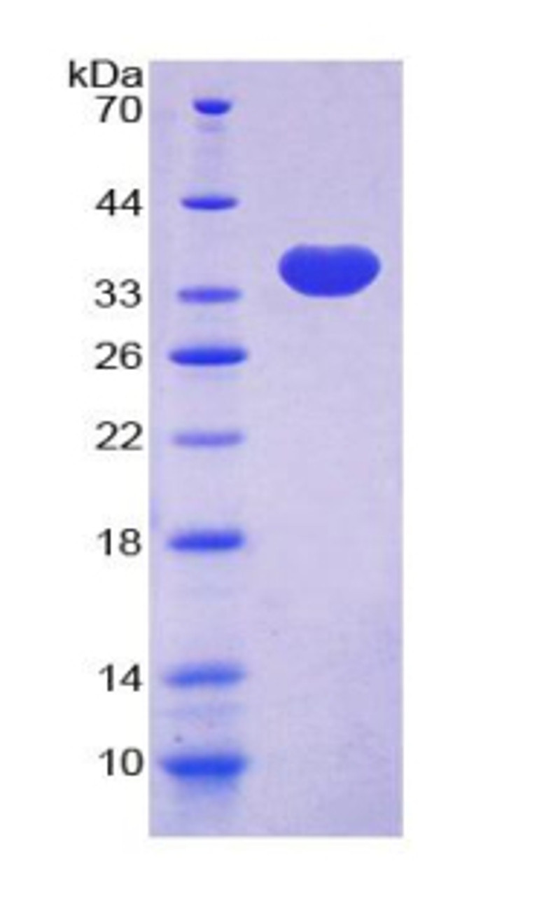 Human Recombinant Myosin Heavy Chain 10, Non Muscle (MYH10)